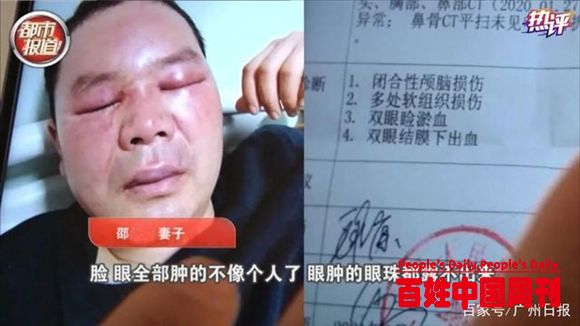 央视热评：彻查殴打污染举报者，关涉社会公平正义